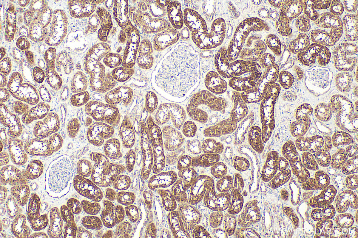 IHC staining of human kidney using 27048-1-AP IHC staining of human kidney using 27048-1-AP