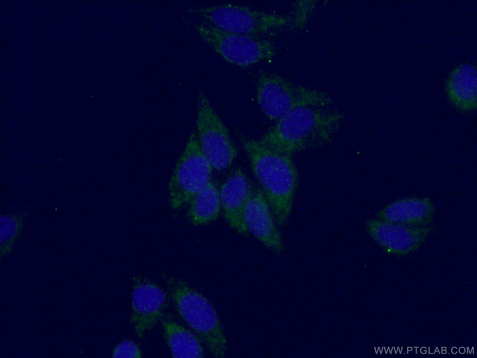 IF Staining of HepG2 using 14511-1-AP