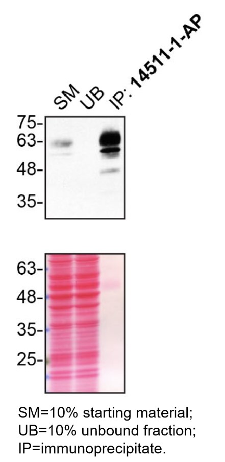 IP experiment of HCT 116 using 14511-1-AP