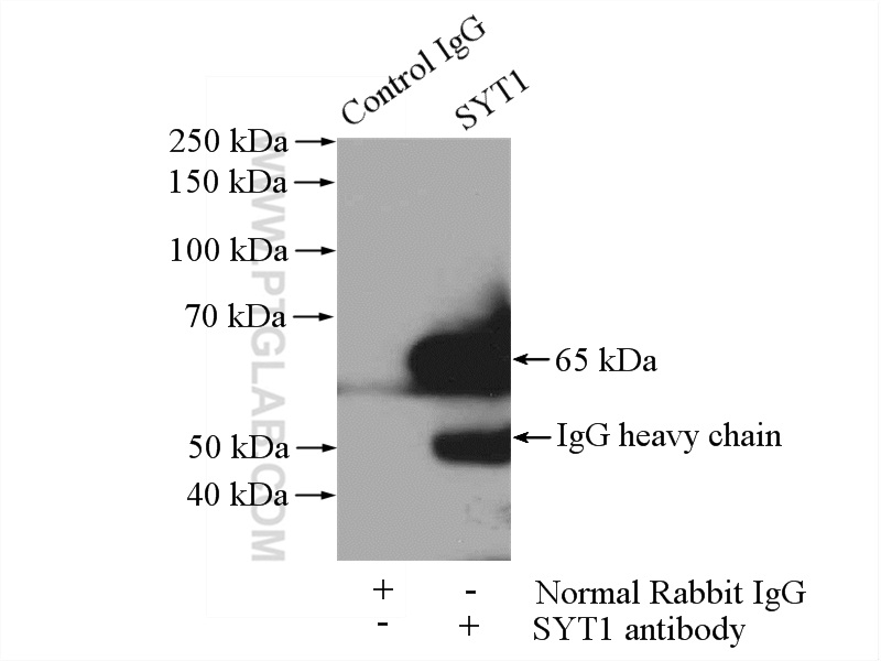 IP experiment of mouse testis using 14511-1-AP