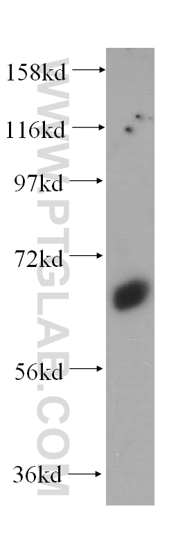 Synaptotagmin-1 Polyclonal antibody