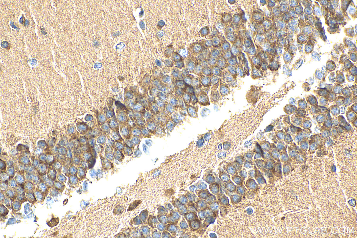 IHC staining of mouse brain using 12031-1-AP