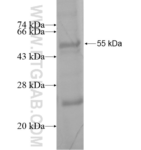 SYT15 fusion protein Ag15468 SDS-PAGE SYT15 fusion protein Ag15468 SDS-PAGE
