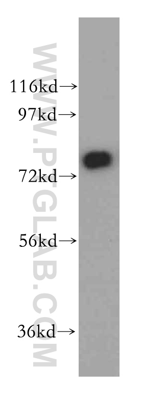 WB analysis of human kidney using 15413-1-AP