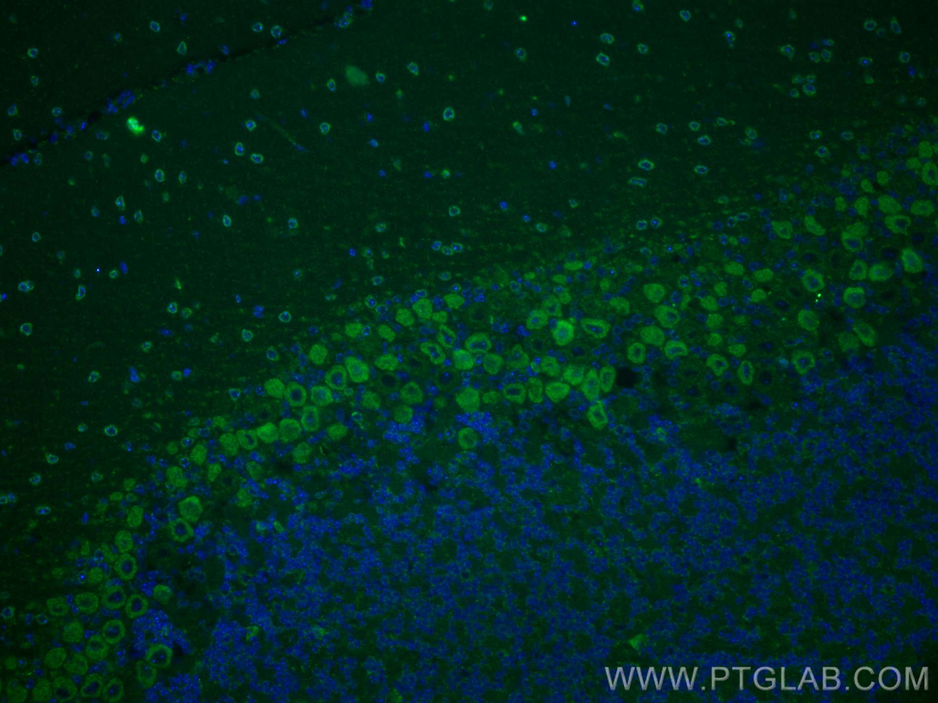 IF Staining of mouse cerebellum using 21245-1-AP