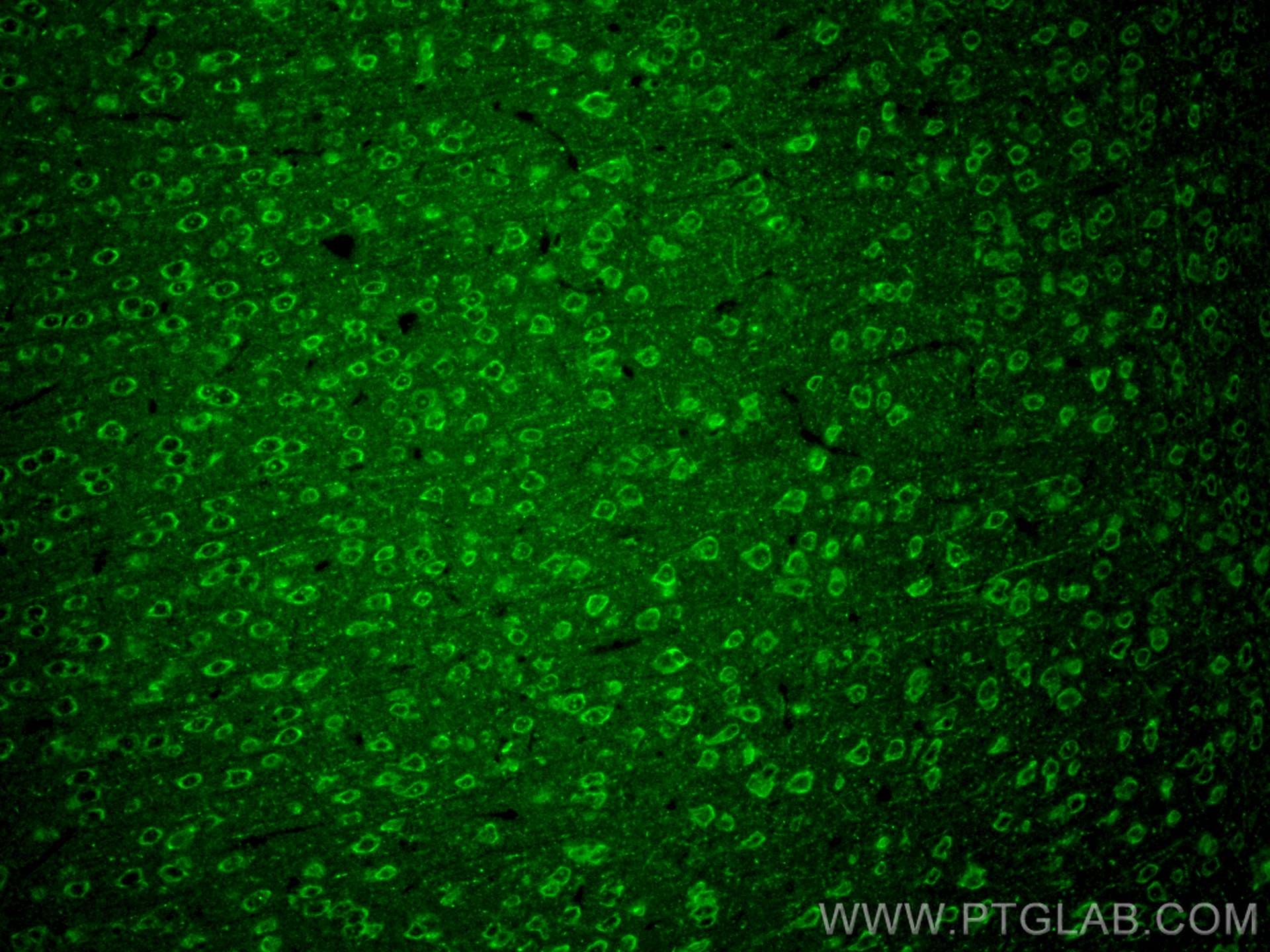 IF Staining of mouse brain using 18124-1-AP