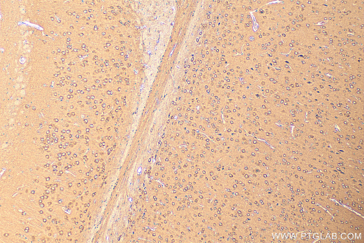 IHC staining of mouse brain using 19741-1-AP