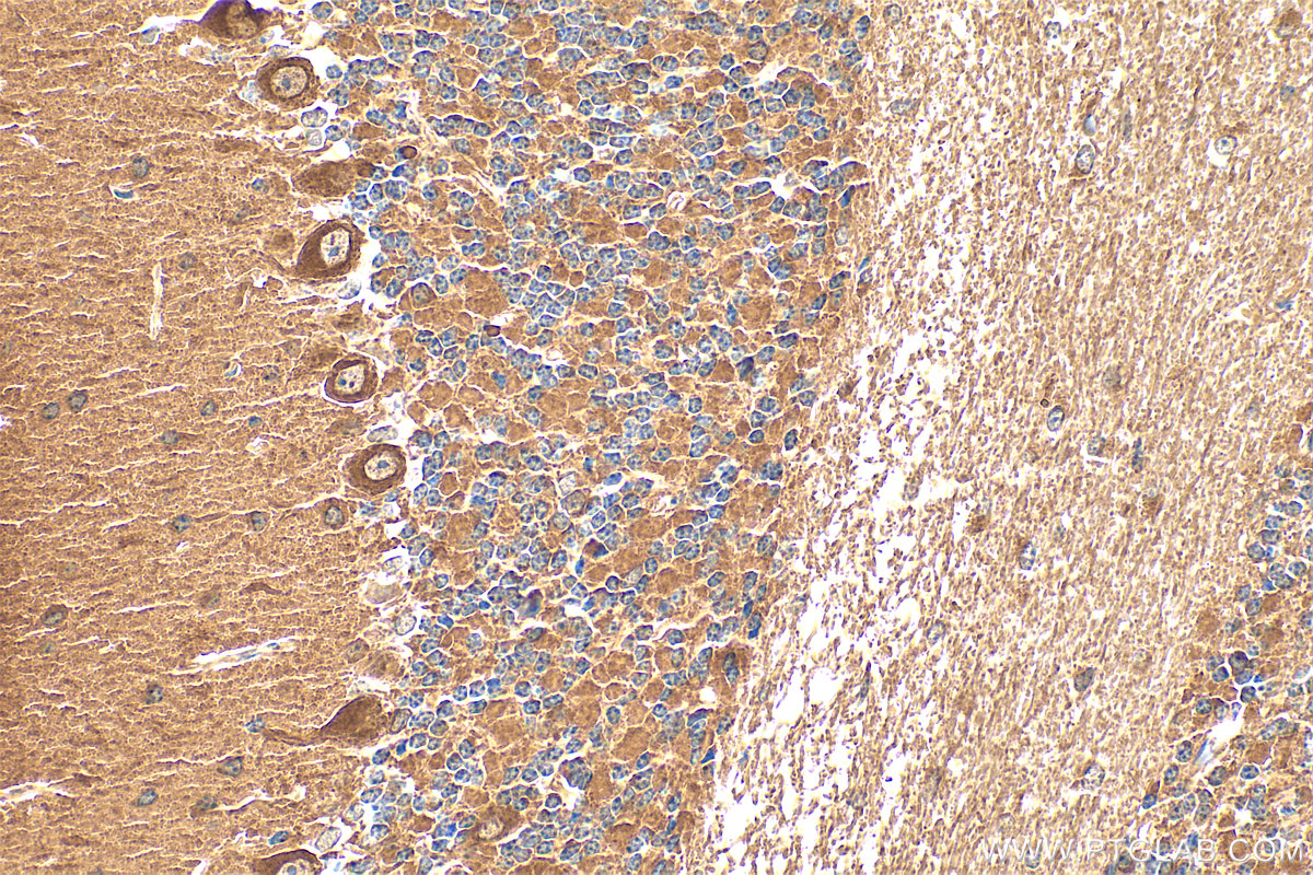 IHC staining of mouse cerebellum using 19741-1-AP