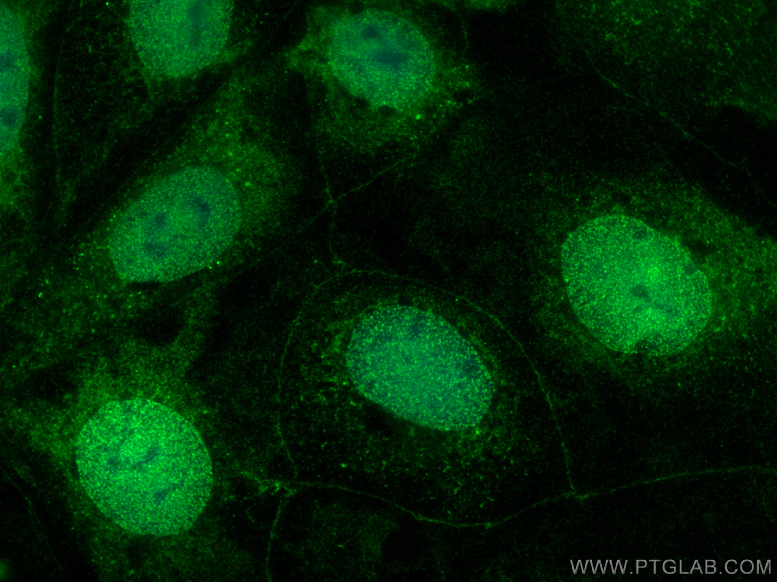 IF Staining of Caco-2 using 20671-1-AP