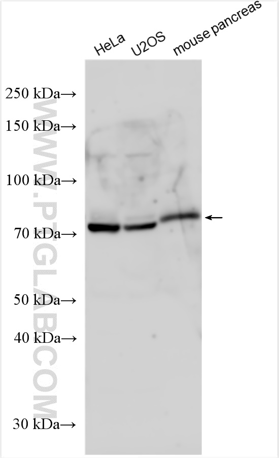 WB analysis using 12128-1-AP