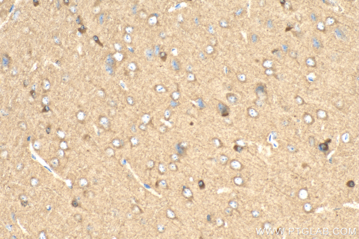 IHC staining of mouse brain using 24528-1-AP (same clone as 24528-1-PBS)
