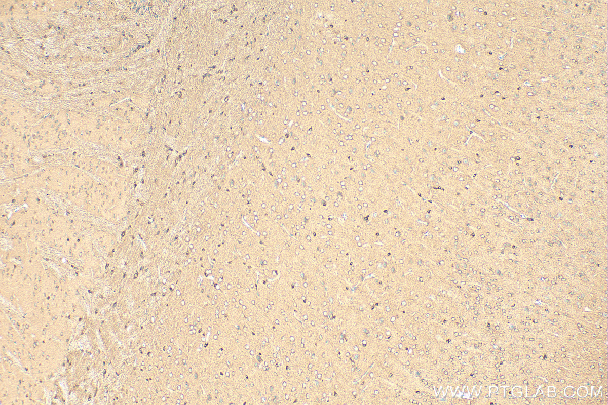IHC staining of mouse brain using 24528-1-AP (same clone as 24528-1-PBS)