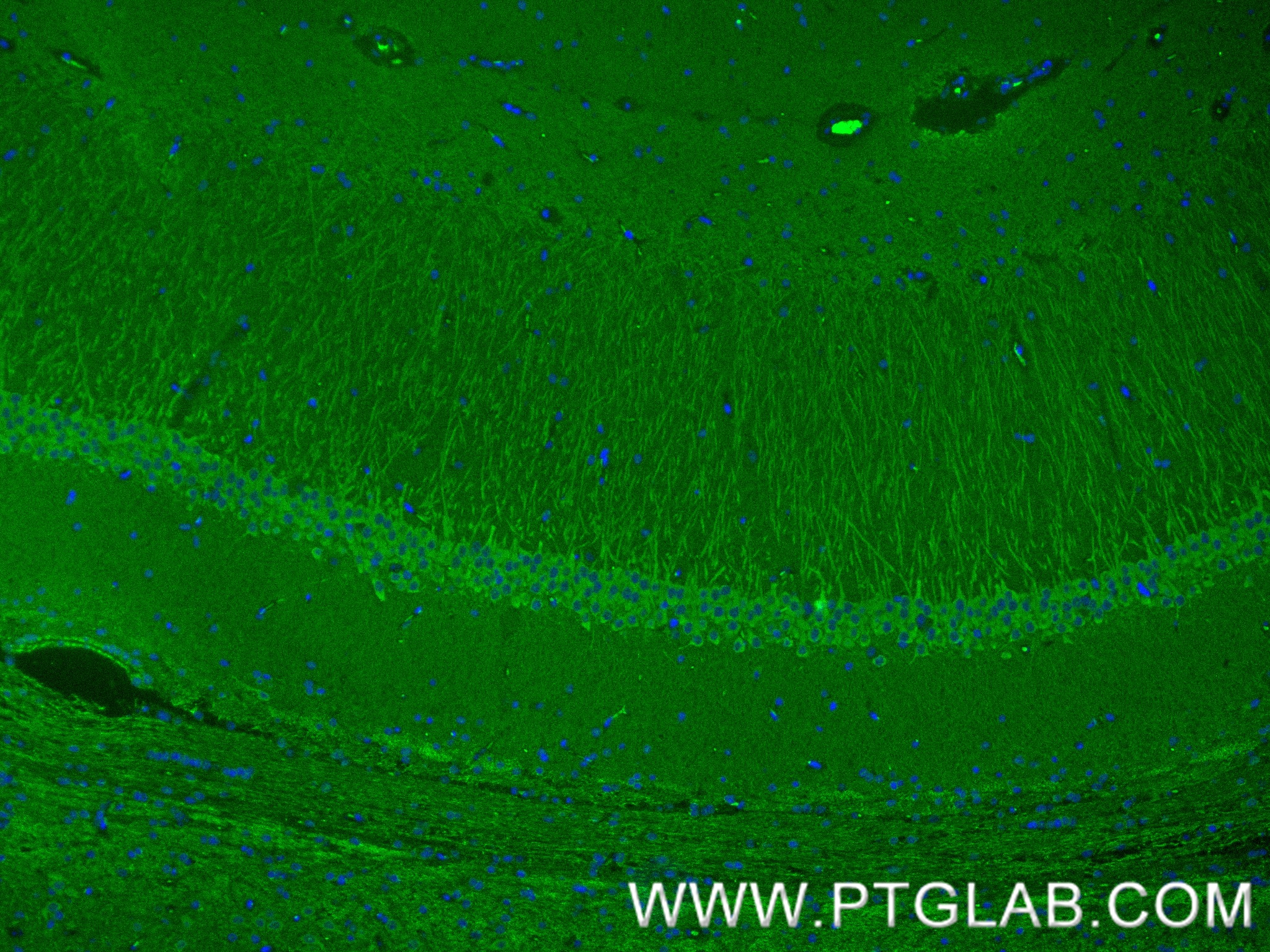 IF Staining of rat brain using 85108-5-RR (same clone as 85108-5-PBS)