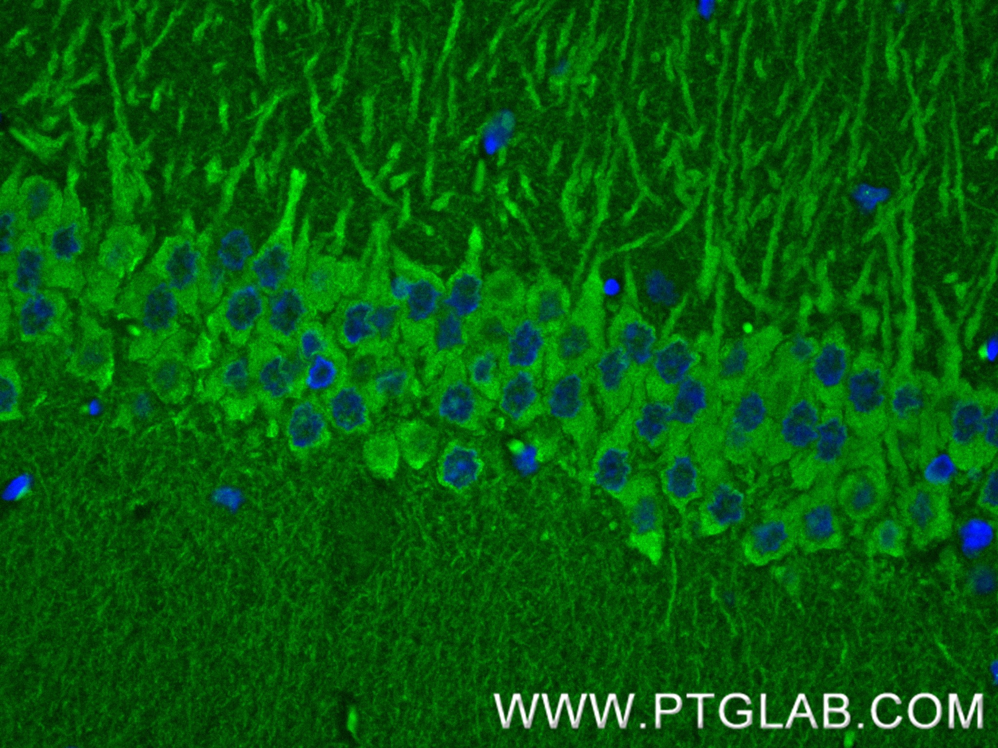 IF Staining of rat brain using 85108-5-RR (same clone as 85108-5-PBS)