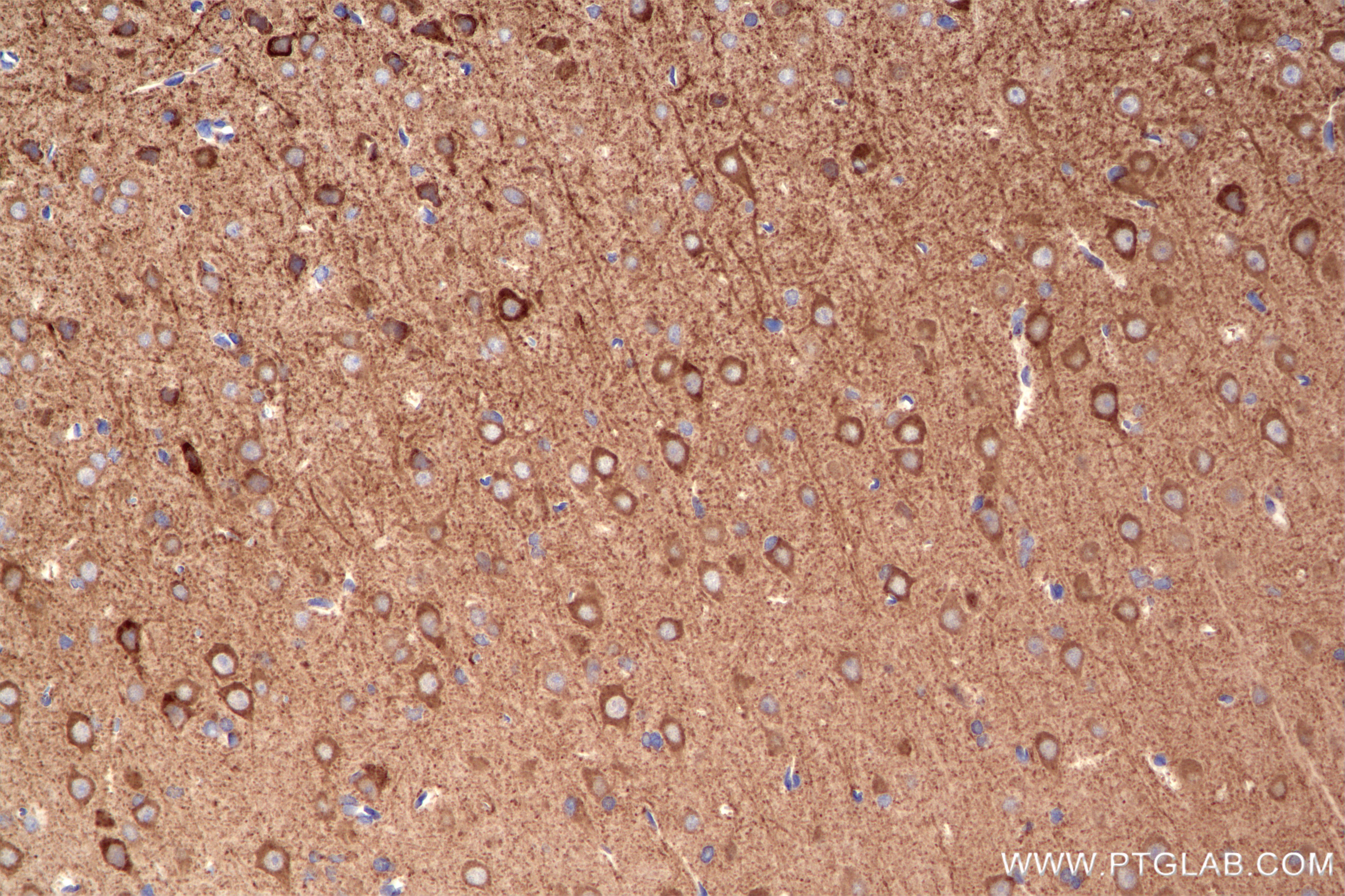 IHC staining of rat brain using 85108-5-RR