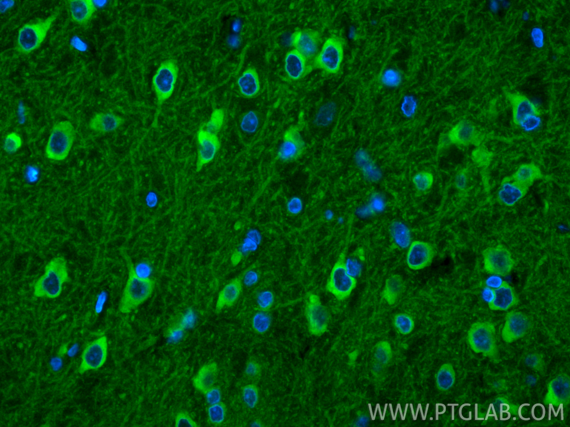 IF Staining of rat brain using CL488-85108-5