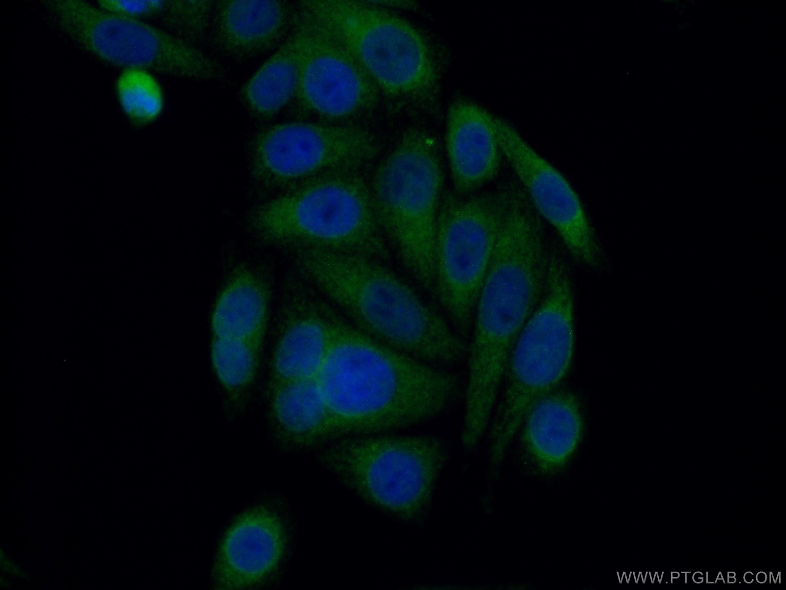 IF Staining of HepG2 using 13473-1-AP