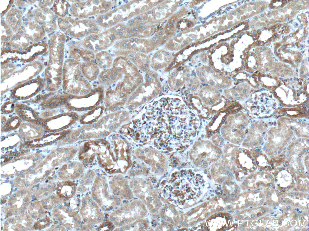 IHC staining of human kidney using 13473-1-AP