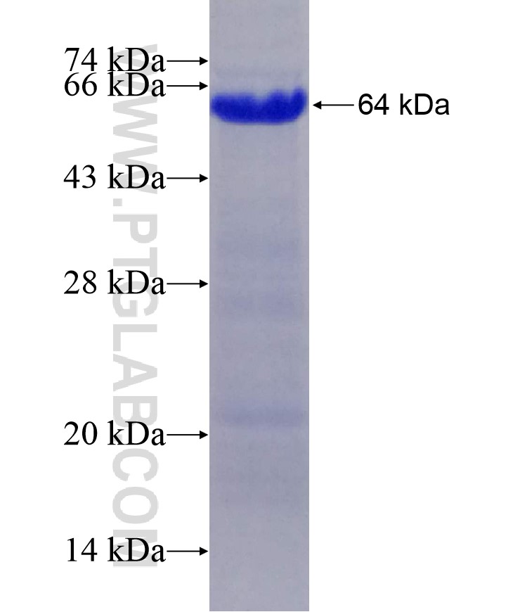 HRD1 fusion protein Ag4456 SDS-PAGE