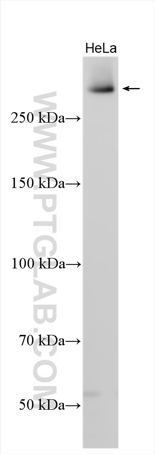 WB analysis using 33062-1-AP WB analysis using 33062-1-AP