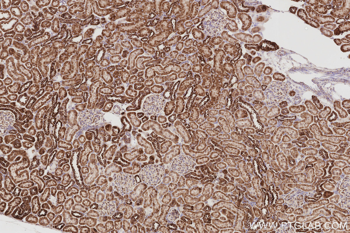 IHC staining of rat kidney using 28679-1-AP IHC staining of rat kidney using 28679-1-AP