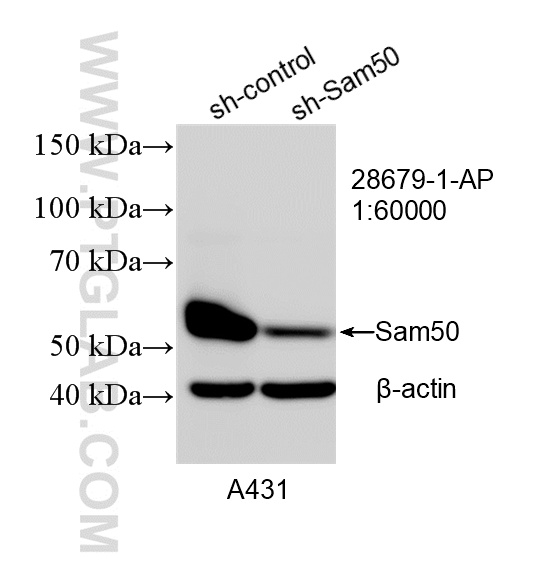 WB analysis of A431 using 28679-1-AP