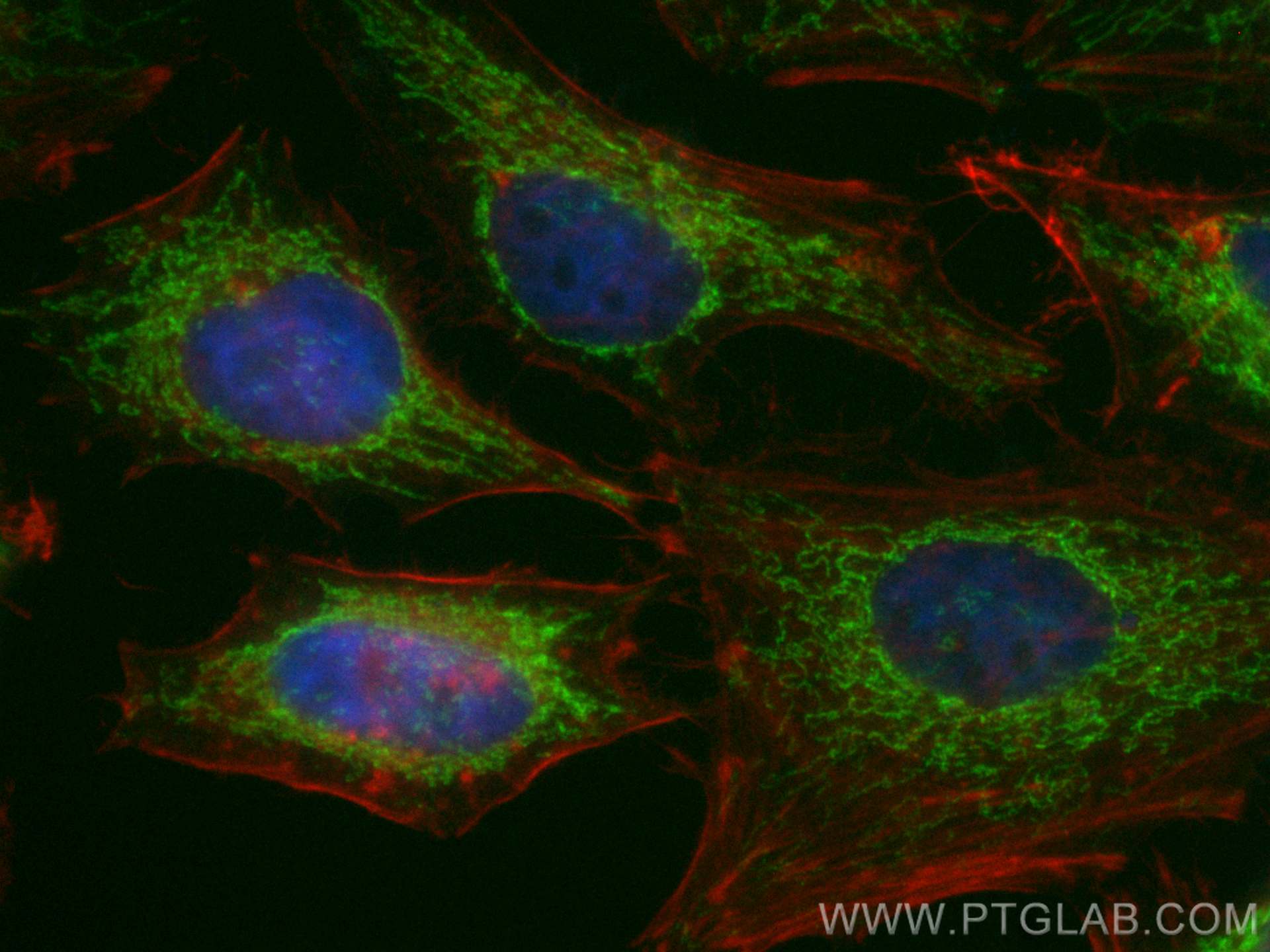 IF Staining of HeLa using CL488-28679