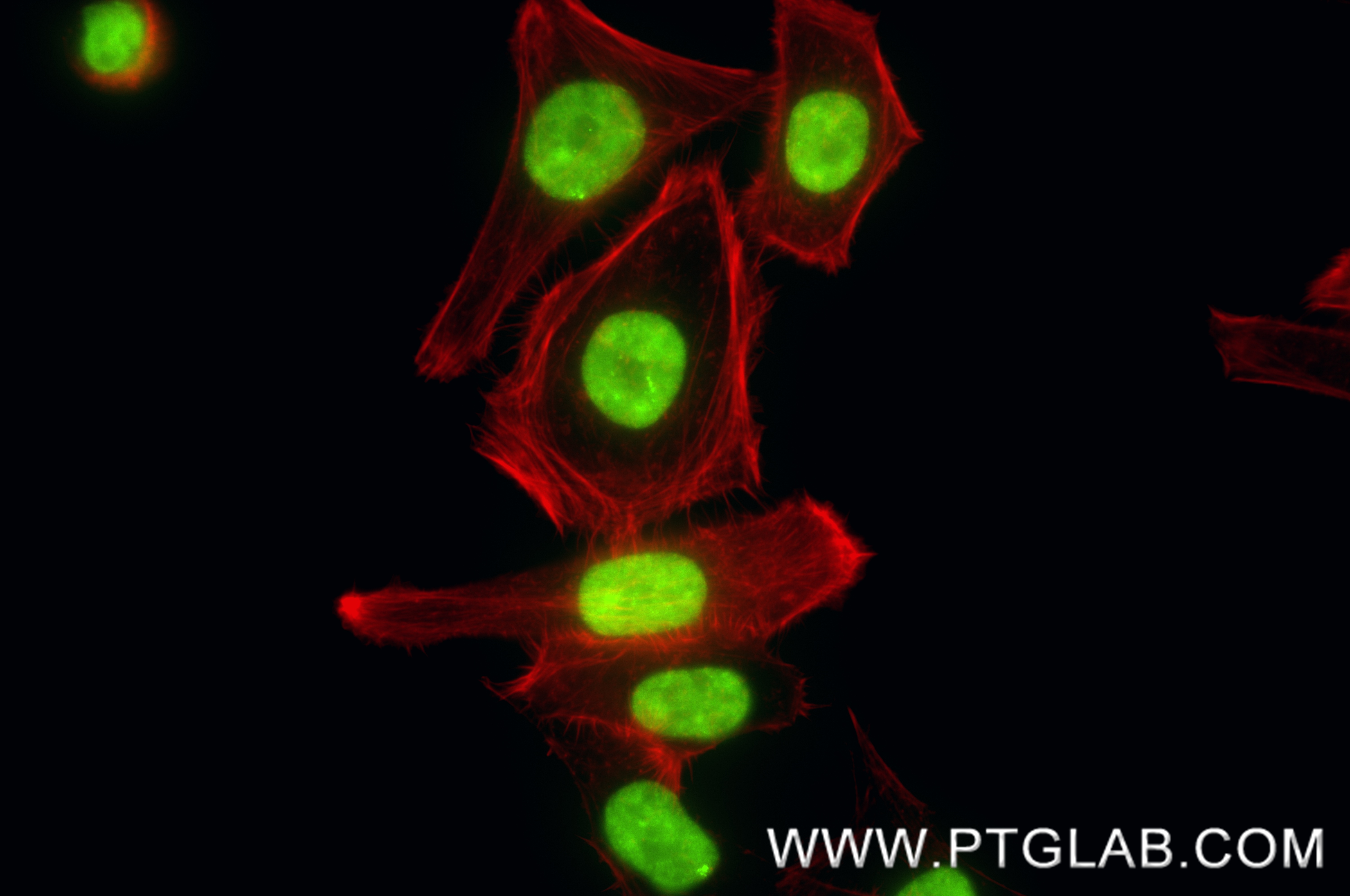 IF Staining of HepG2 using 88301-1-RR IF Staining of HepG2 using 88301-1-RR