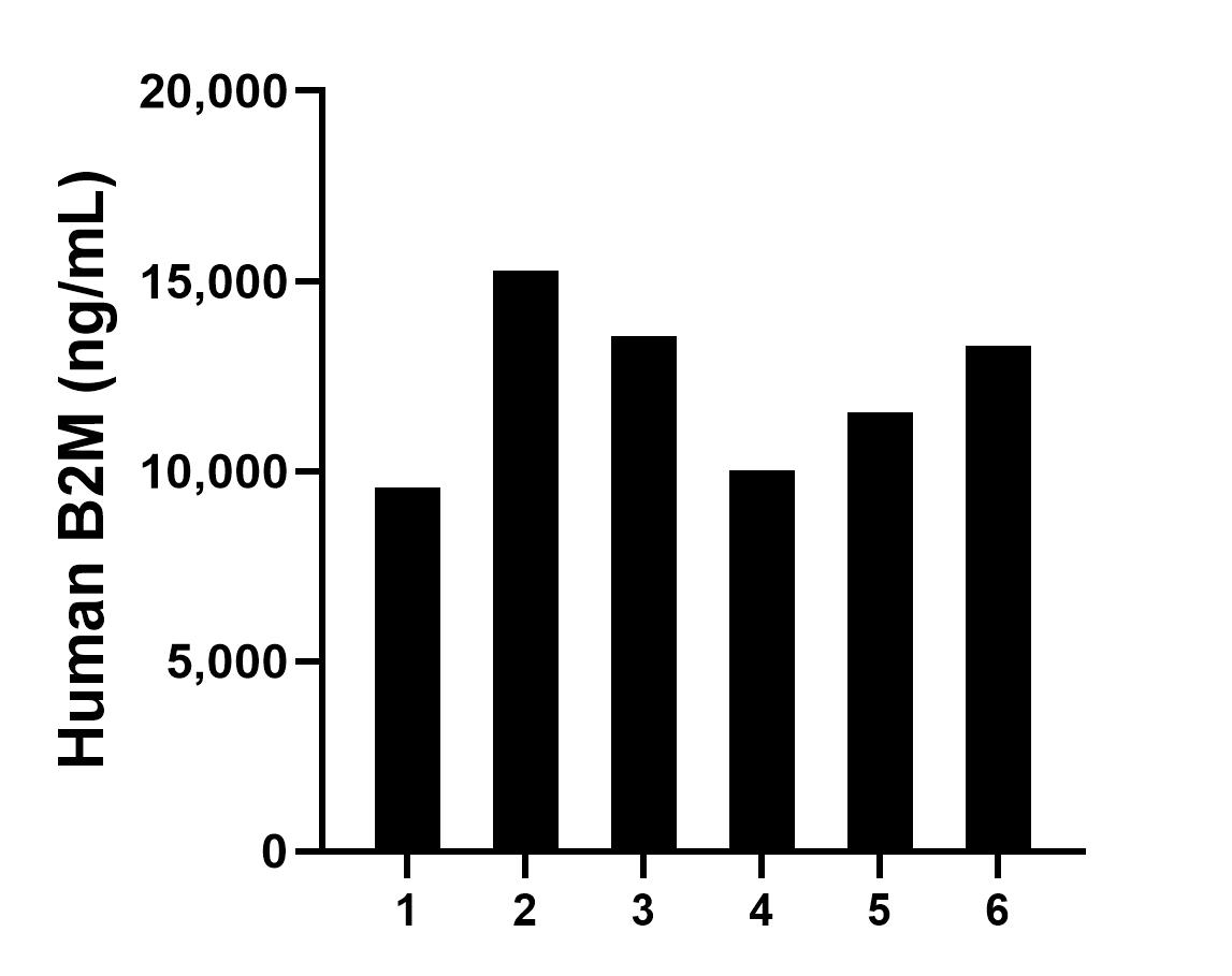 Serum of six individual healthy human donors was measured. The human B2M concentration of detected samples was determined to be 12,201.96 ng/mL with a range of 9,574.44 - 15,258.19 ng/mL.