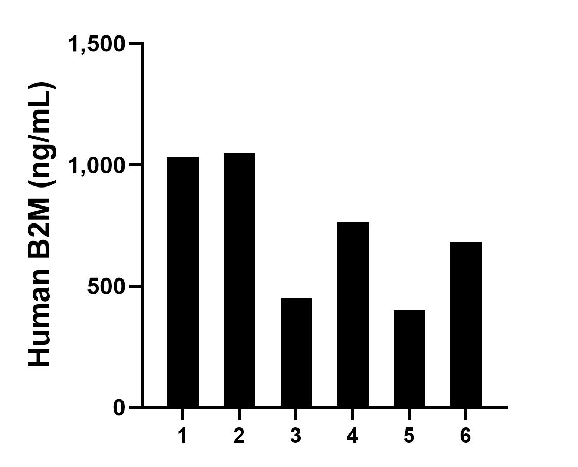 Urine of six individual healthy human donors was measured. The human B2M concentration of detected samples was determined to be 728.33 ng/mL with a range of 399.66 - 1,048.75 ng/mL.