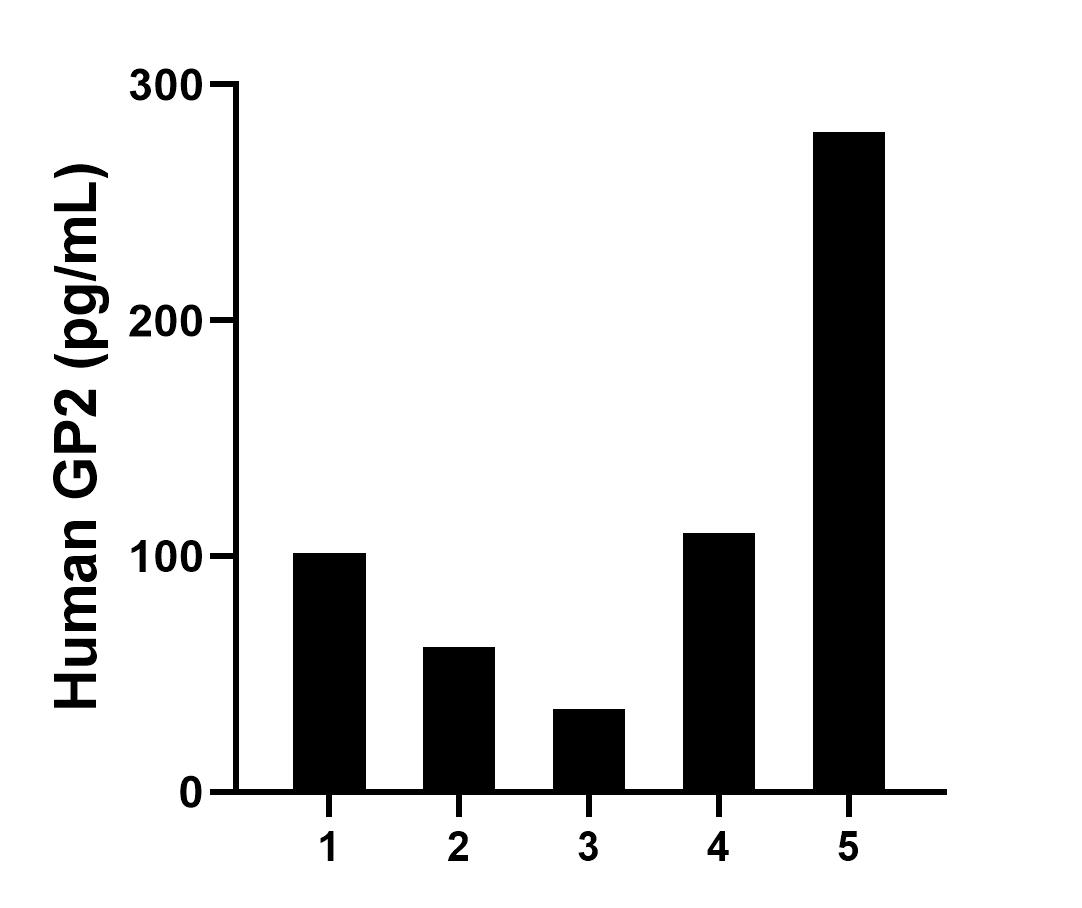 Sample test of MP01513-2