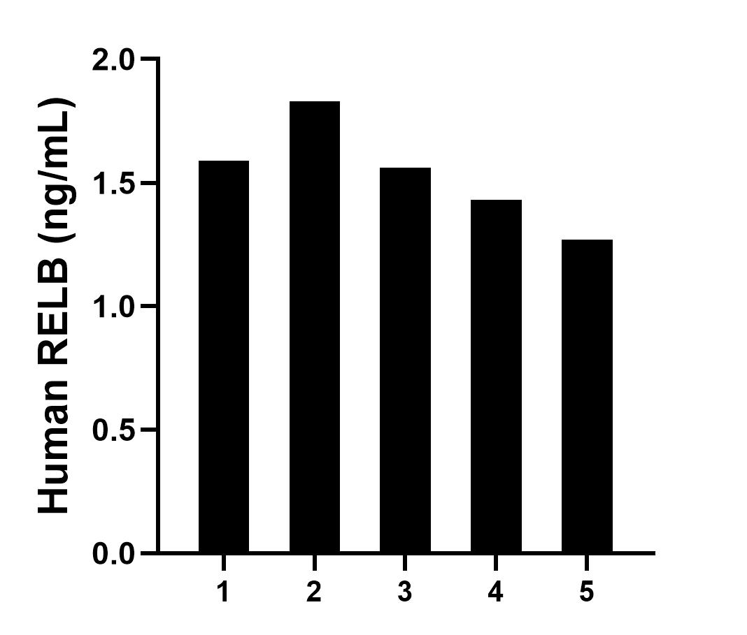Serum of five individual healthy human donors was measured. The RELB concentration of detected samples was determined to be 1.5 ng/mL with a range of 1.3-1.8 ng/mL.	