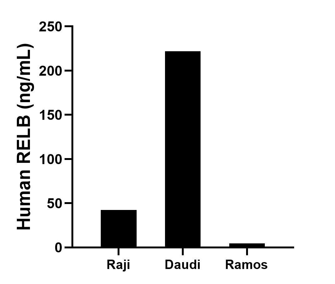 The mean RELB concentration was determined to be 42.5 ng/mL in Raji cell extract based on a 1.4 mg/mL extract load, 221.9 ng/mL in Daudi cell extract based on a 3.6 mg/mL extract load and 4.5 ng/mL in Ramos cell extract based on a 1.4 mg/mL extract load.