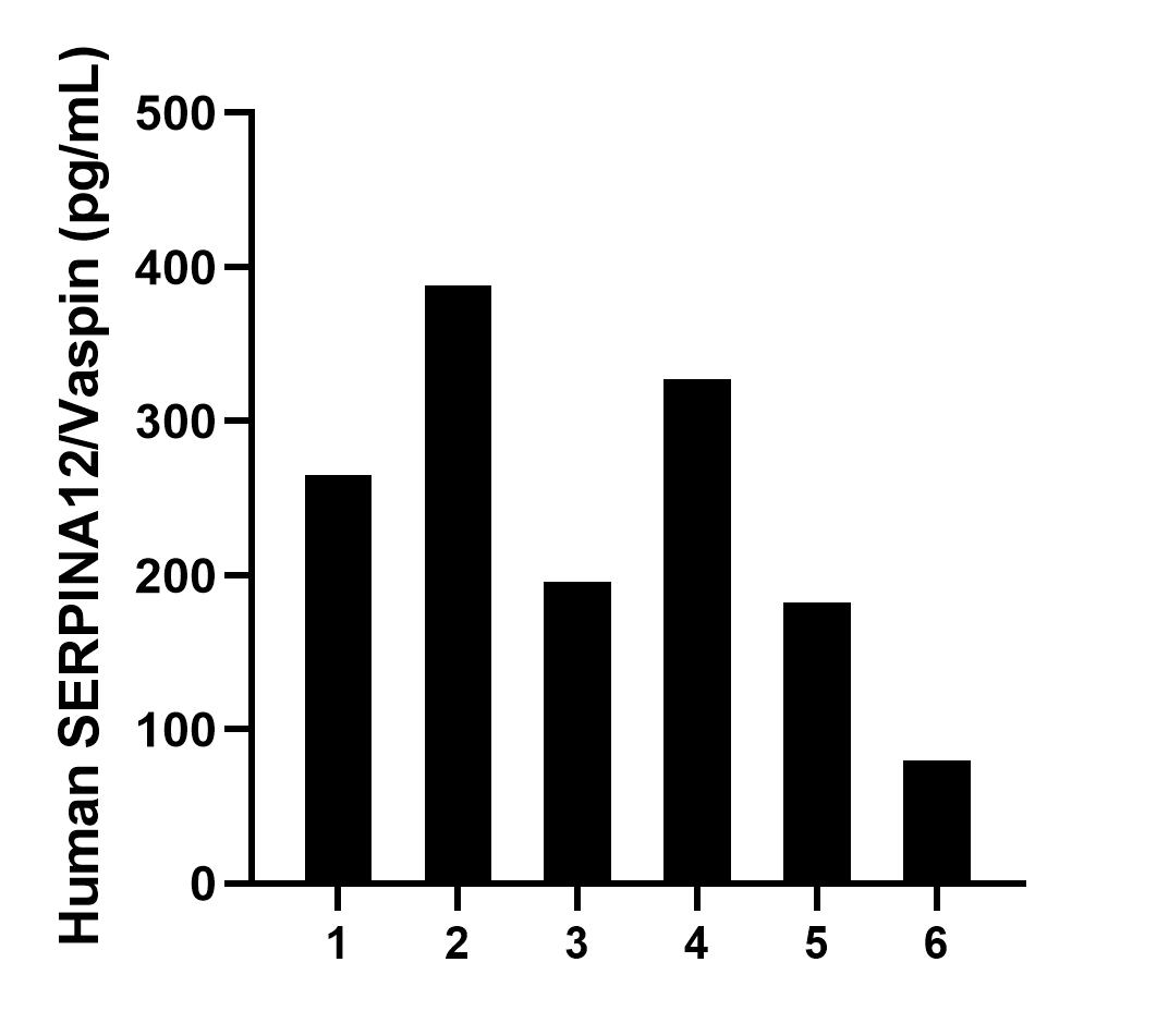 Serum of six individual healthy human donors was measured. The SERPINA12/Vaspin concentration of detected samples was determined to be 239.7 pg/mL with a range of 79.8-388.0 pg/mL.	