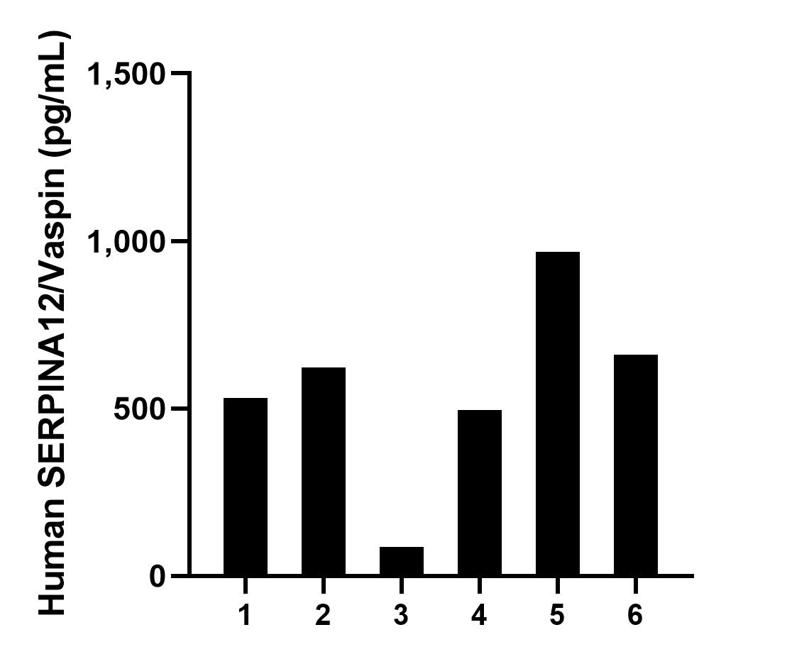Saliva of six individual healthy human donors was measured. The SERPINA12/Vaspin concentration of detected samples was determined to be 560.7 pg/mL with a range of 87.5-968.1 pg/mL.	