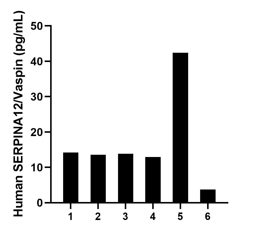 Urine of six individual healthy human donors was measured. The SERPINA12/Vaspin concentration of detected samples was determined to be 16.8 pg/mL with a range of 3.7-42.4 pg/mL.	