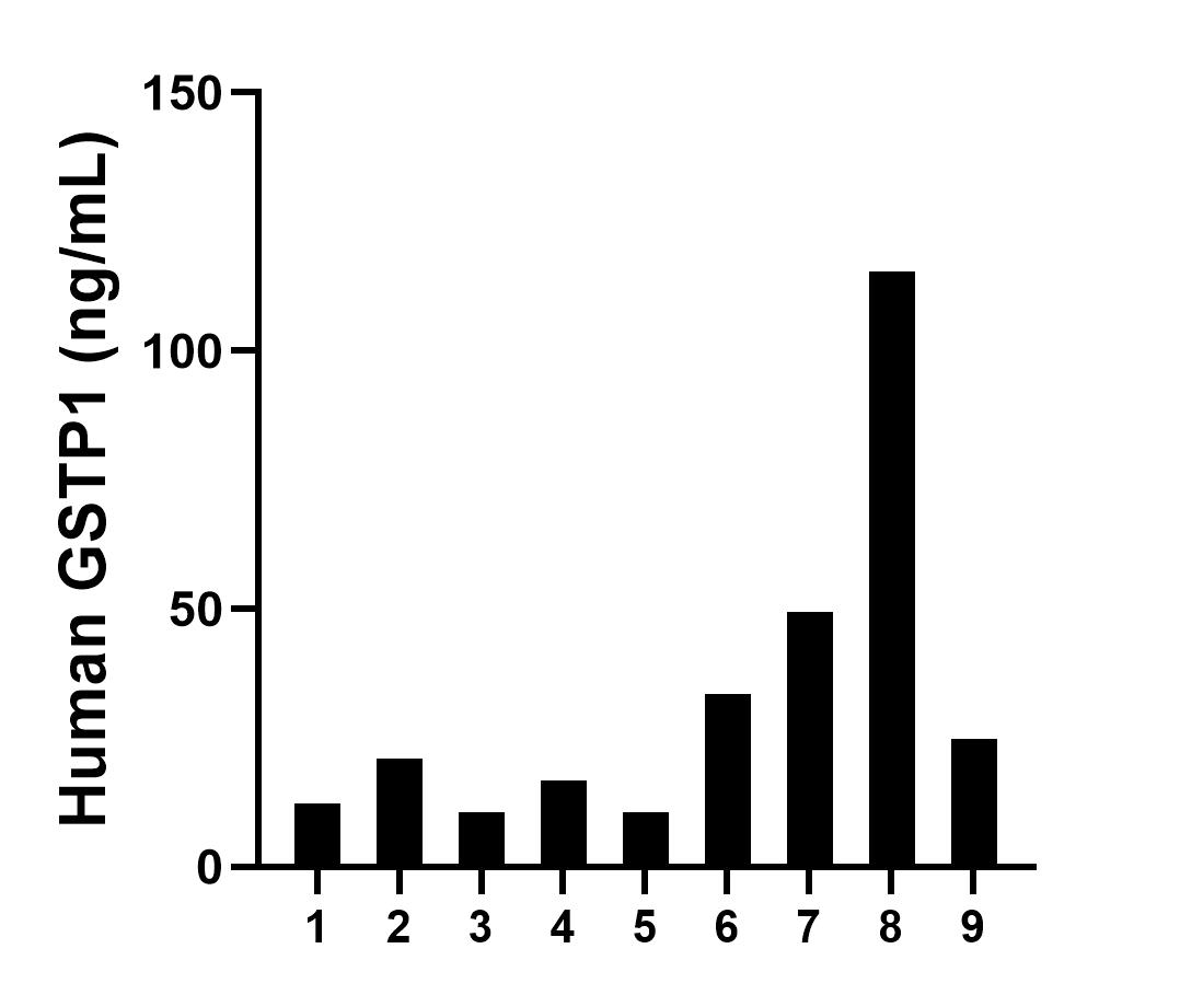Plasma of nine individual healthy human donors was measured. The GSTP1 concentration of detected samples was determined to be 32.7 ng/mL with a range of 10.5-115.3 ng/mL. Plasma of nine individual healthy human donors was measured. The GSTP1 concentration of detected samples was determined to be 32.7 ng/mL with a range of 10.5-115.3 ng/mL.