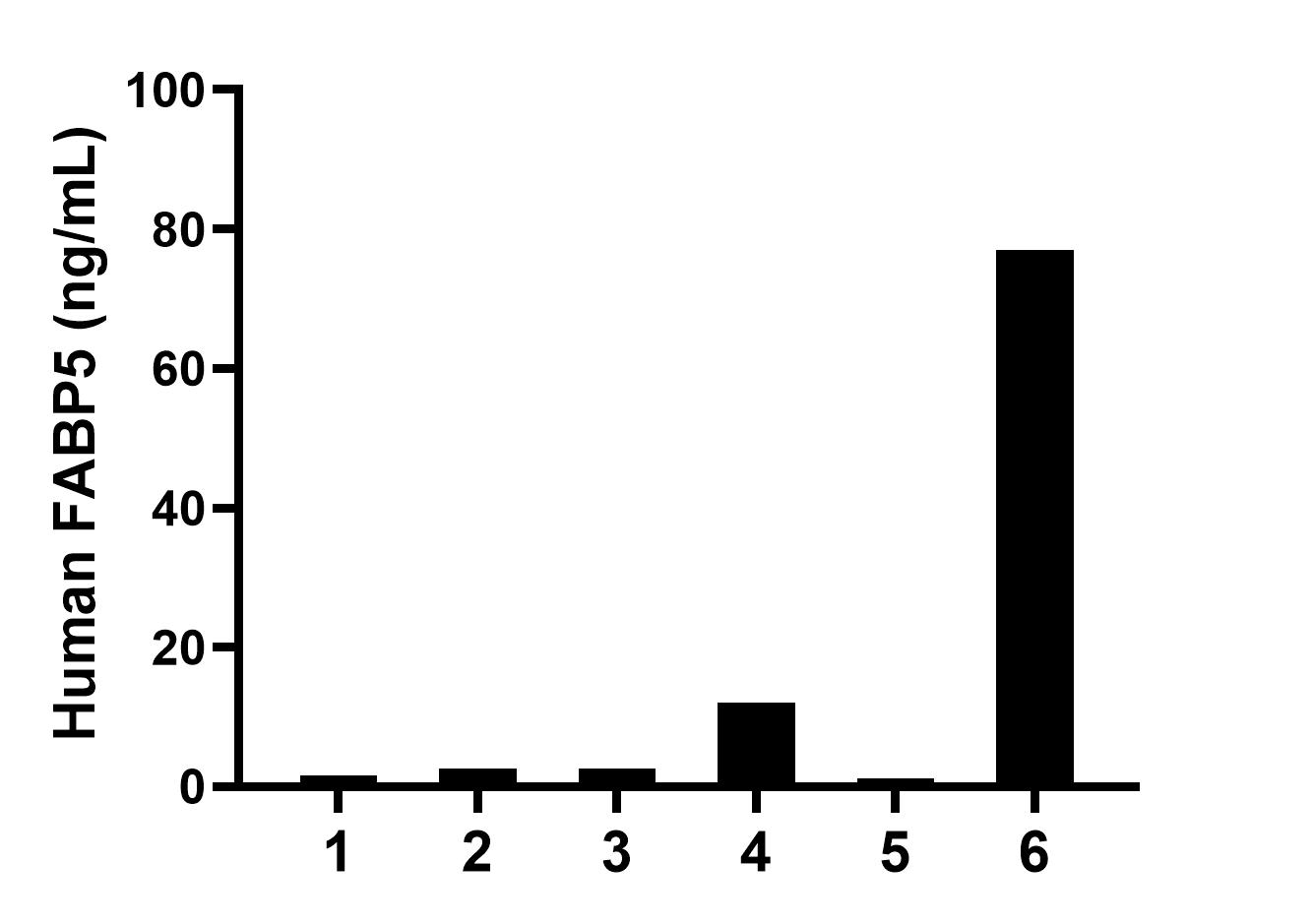 Urine of six individual healthy human donors was measured. The FABP5 concentration of detected samples was determined to be 16.17 ng/mL with a range of 1.14-77.03 ng/mL. Sandwich ELISA sample test of MP02674-1