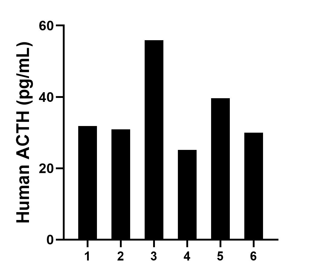 Plasma of six individual healthy human donors was measured. The ACTH concentration of detected samples was determined to be 35.6 pg/mL with a range of 25.1-55.9 pg/mL. Sandwich ELISA sample test of MP02726-1