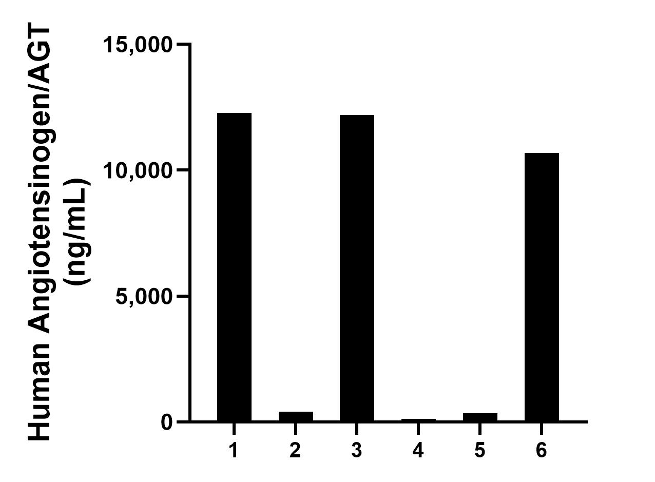 Serum of six individual healthy human donors was measured. The Angiotensinogen/AGT concentration of detected samples was determined to be 6,000.61 ng/mL with a range of 118.04 -12,267.72 ng/mL. Serum of six individual healthy human donors was measured. The Angiotensinogen/AGT concentration of detected samples was determined to be 6,000.61 ng/mL with a range of 118.04 -12,267.72 ng/mL.