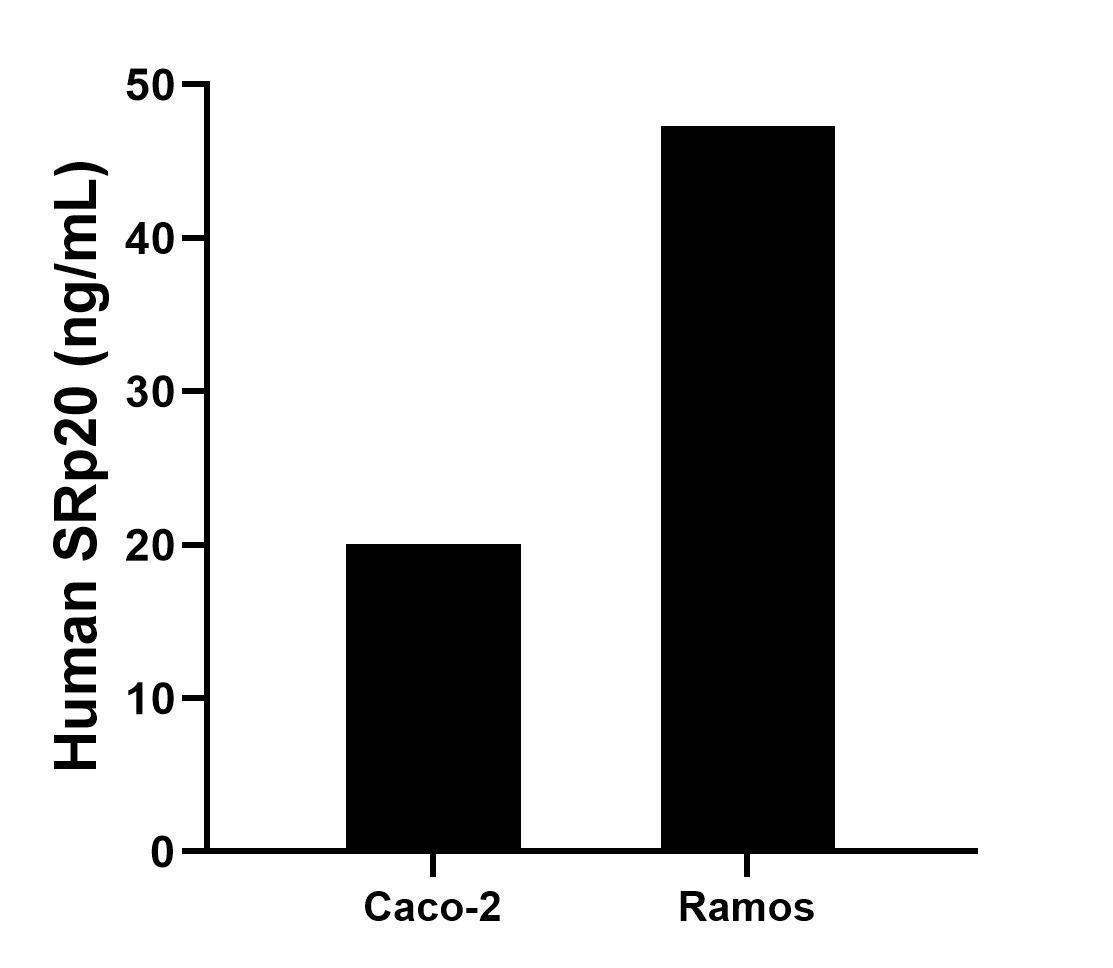 The mean SRp20 concentration was determined to be 20.09 ng/mL in Caco-2 cell extract based on a 1.2 mg/mL extract load and 47.32 ng/mL in Ramos cell extract based on a 1.2 mg/mL extract load. The mean SRp20 concentration was determined to be 20.09 ng/mL in Caco-2 cell extract based on a 1.2 mg/mL extract load and 47.32 ng/mL in Ramos cell extract based on a 1.2 mg/mL extract load.