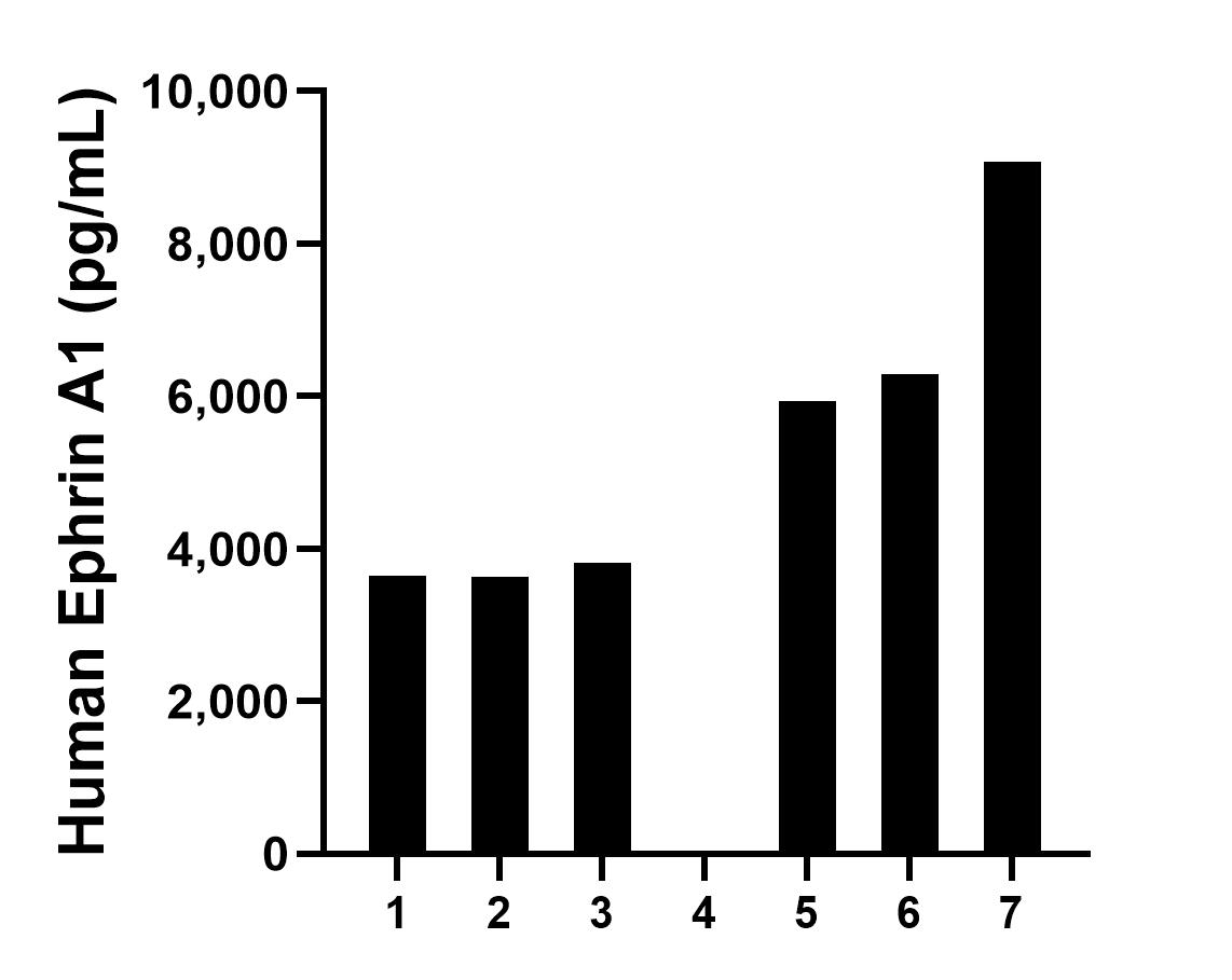 Serum of seven individual healthy human donors was measured. The Ephrin A1 concentration of detected samples was determined to be 4,635.6 pg/mL with a range of 49.2-9,074.2 pg/mL. Sandwich ELISA sample test of MP03040-2