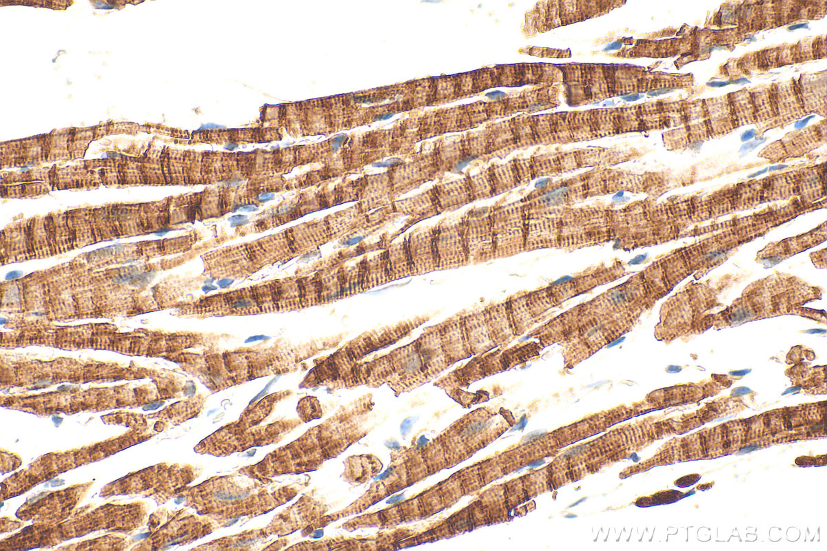 IHC staining of mouse heart using 33909-1-AP (same clone as 33909-1-PBS) IHC staining of mouse heart using 33909-1-AP (same clone as 33909-1-PBS)