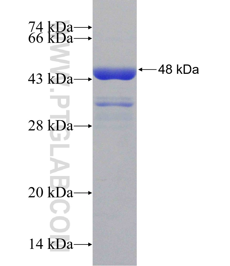 Scpep1 fusion protein Ag31457 SDS-PAGE
