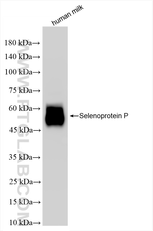 WB analysis of human milk using 85017-4-RR (same clone as 85017-4-PBS)