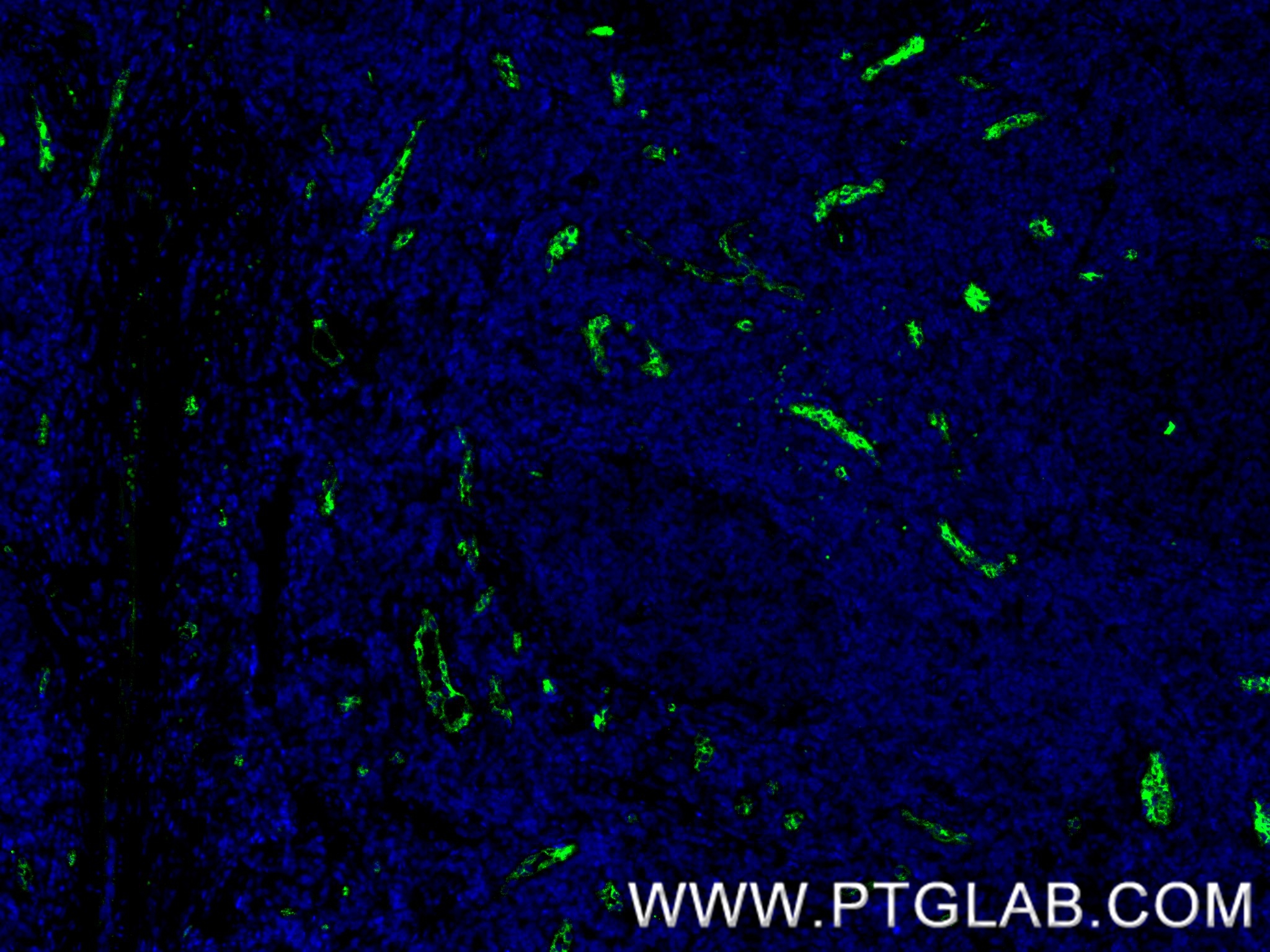IF Staining of human tonsillitis using 83947-5-RR
