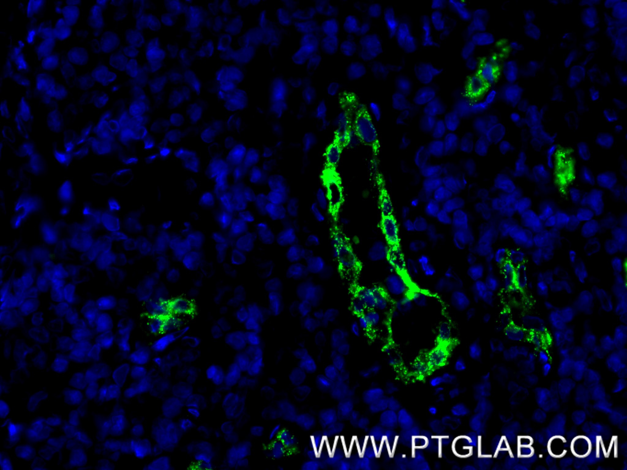 IF Staining of human tonsillitis using 83947-5-RR