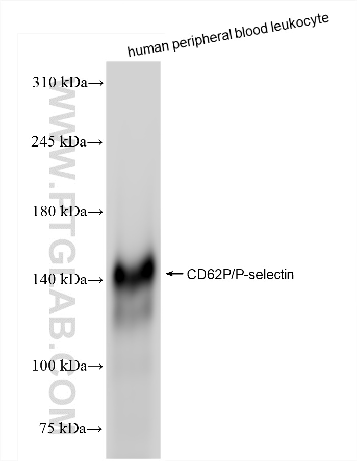 WB analysis of human peripheral blood leukocyte using 83947-5-RR