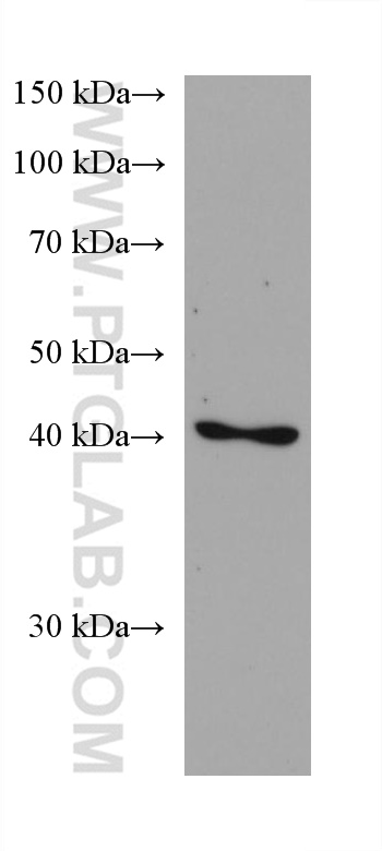 Septin 5