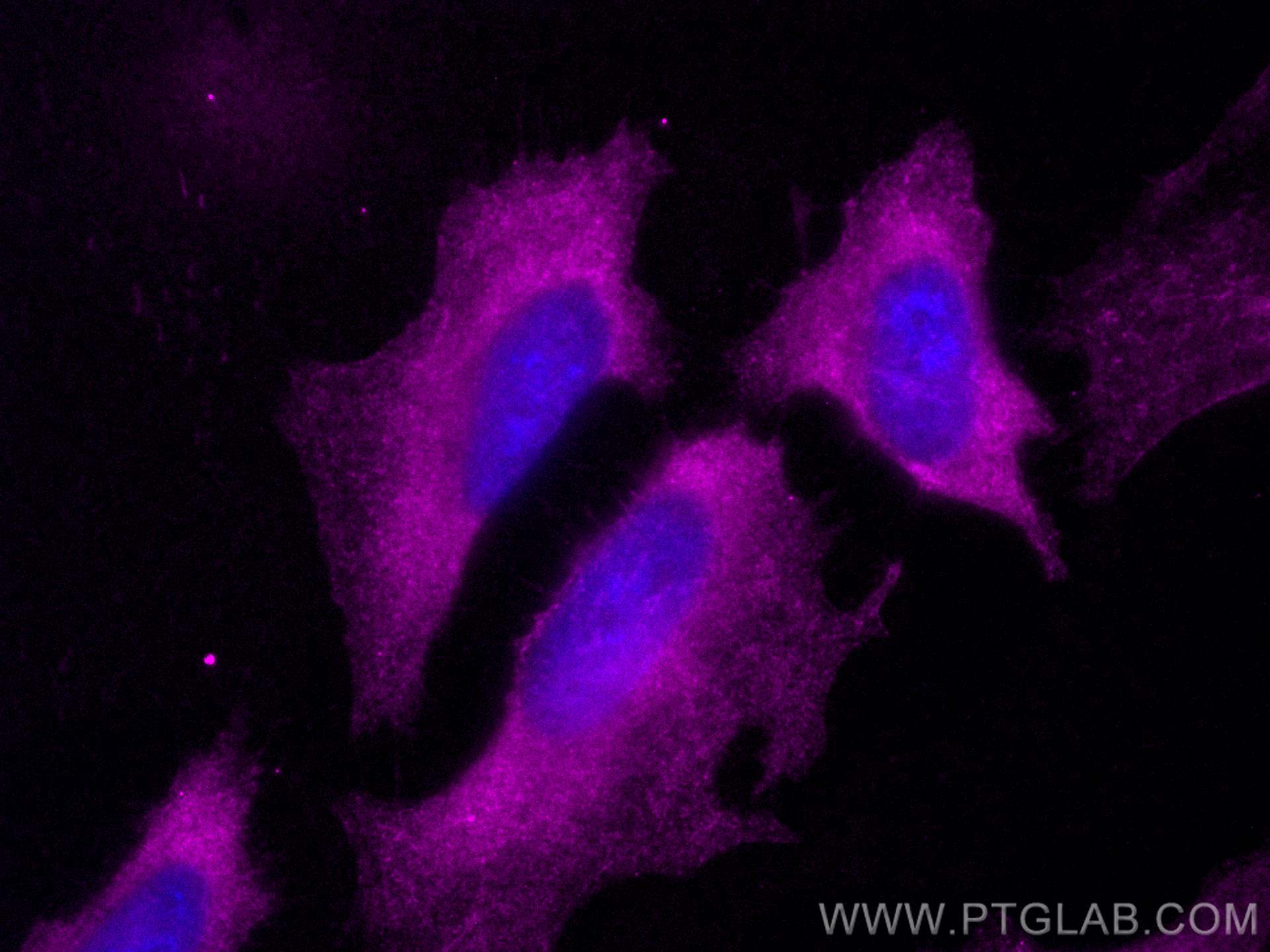 IF Staining of HeLa using CL647-10769